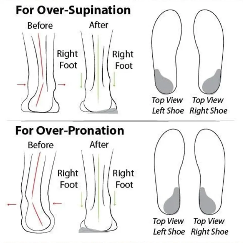 Women's Soft Sole Mesh Comfort Orthopedic Shoes, 2024 New Low-top Women Arch Support Walking Shoes, Casual Slip-on Shoes